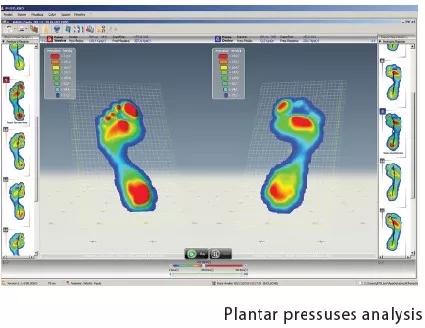 便携式步态分析仪测评：足底压力传感vs惯性传感器